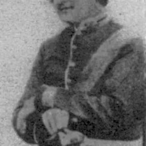Portrait of Robert Christopher Tytler