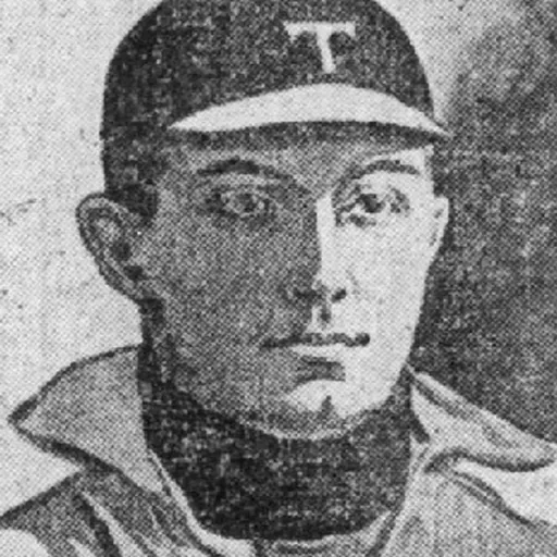 Portrait of Doc Hazelton