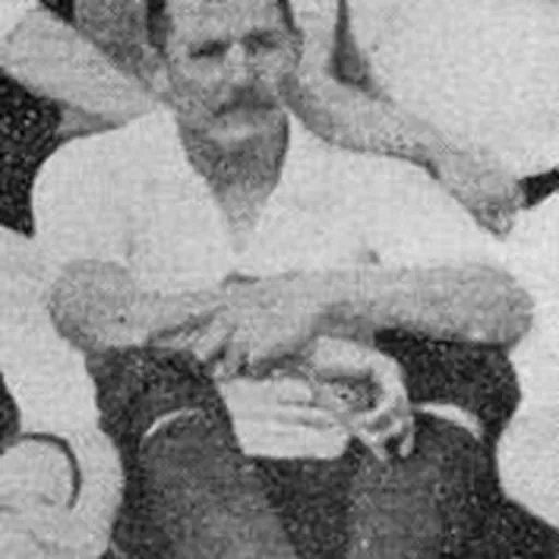 Portrait of Japie Louw