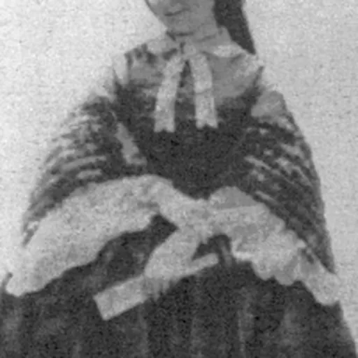 Portrait of Harriet C. Tytler