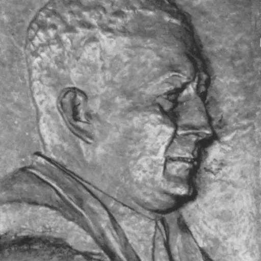 Portrait of Hermann Ehlers