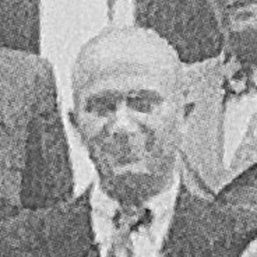 Portrait of Lajos Steiner