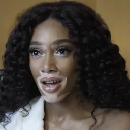 Portrait of Winnie Harlow