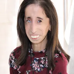 Portrait of Lizzie Velasquez